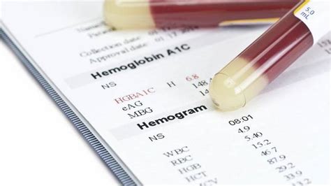 hemogramda mo nedir